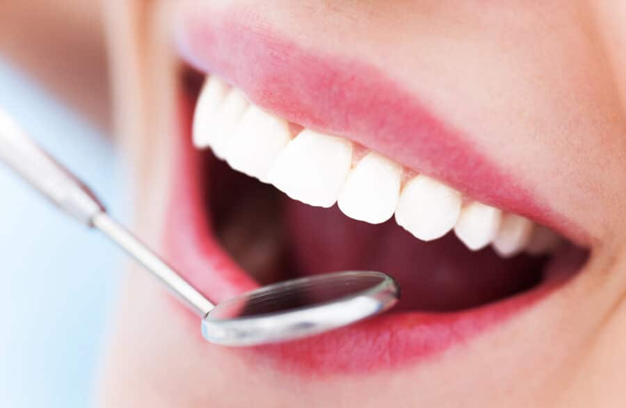 Woman with healthy white teeth in Rapid City SD